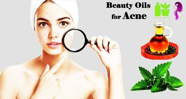 Beauty Oils For Acne